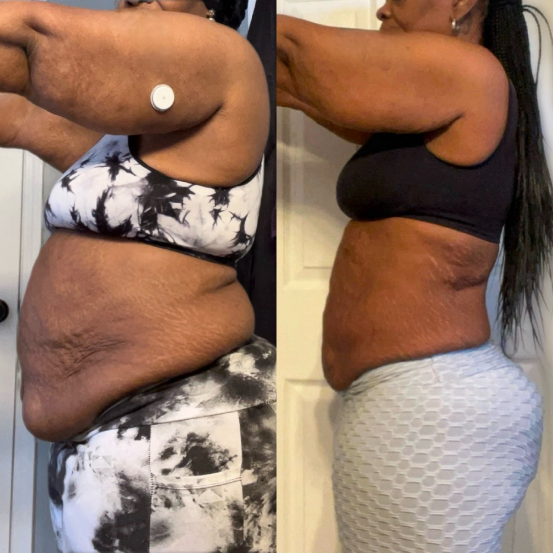 BTHEBODY client transformation